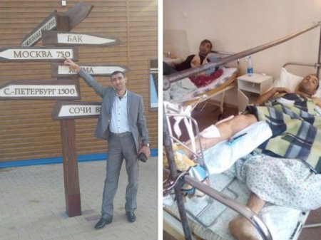 Простой рабочий спас от ампутации ногу гражданина АР, так и не дождавшегося помощи от диаспоры в России