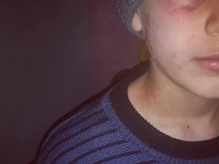 Госкомитет о зверском избиении женщиной сына в Баку 