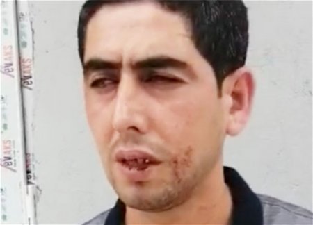 Замначальника полиции избил ветерана Отечественной войны