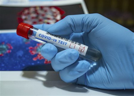 Названа причина задержки выдачи результатов тестирования на COVID-19 в Азербайджане