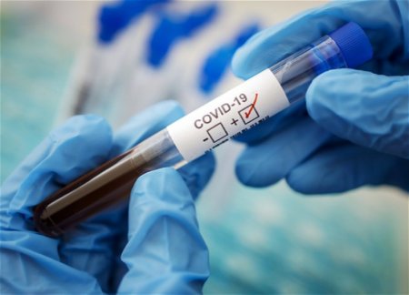 За сутки в Азербайджане 58 новых случаев заражения COVID-19