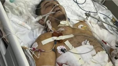 Убивший 2 человек в аэропорту Кишинева Ашуров скончался в больнице