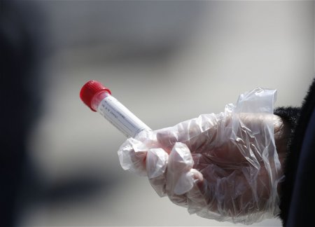 Ежедневный статистический отчет по COVID-19 в Азербайджане больше публиковаться не будет