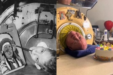 Умер Пол Александр, проживший в аппарате "железных легких" 70 лет