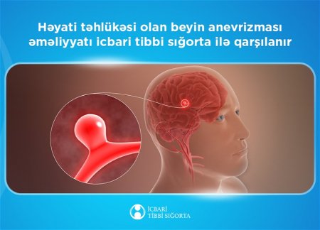 Обязательное медицинское страхование покроет операцию по удалению аневризмы мозга