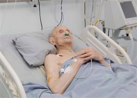 В Баку успешно прооперирован 110-летний пациент