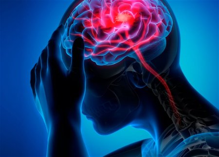 Инсульт значительно чаще поражает бедных людей, выяснили ученые